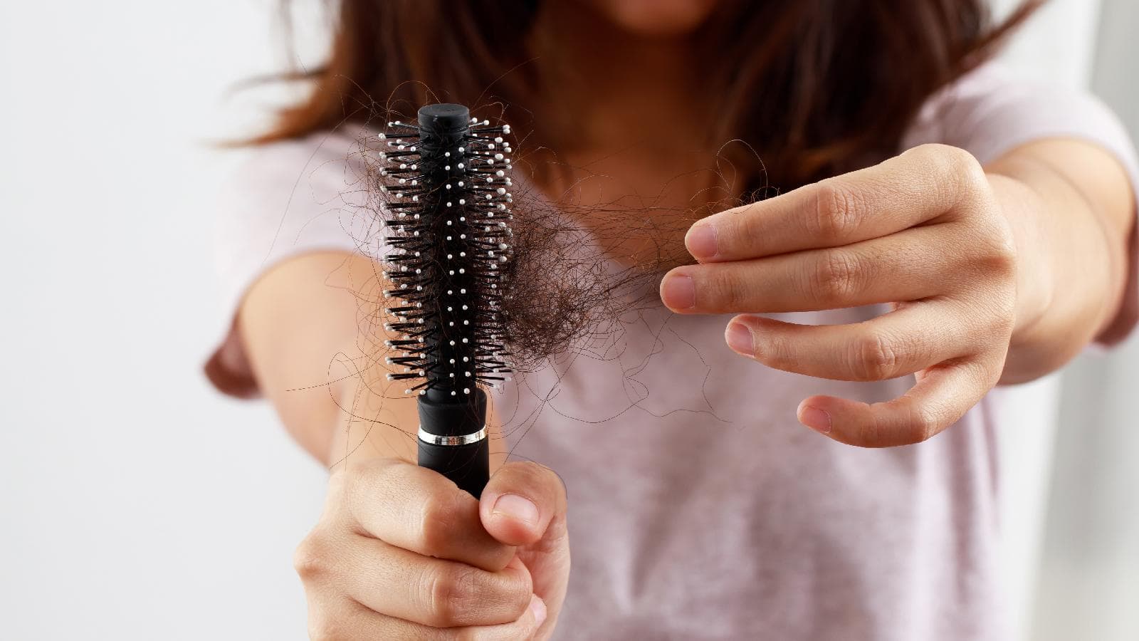 The Surprising Yo Connection Betweenur Your Diet and Hair Loss: Find Out Now